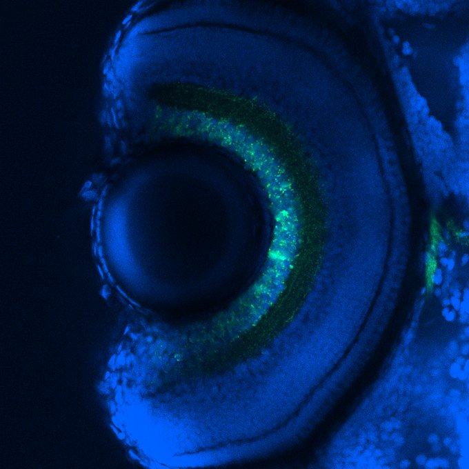 Image of developing Zebrafish eye